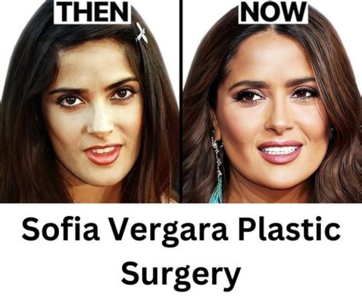 Sof&iacute;a Vergara Plastic Surgery Before and After