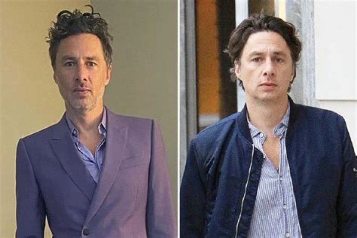 Zach Braff Plastic Surgery